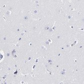 Anti-DCN antibody produced in rabbit Prestige Antibodies® Powered by Atlas Antibodies, affinity isolated antibody, buffered aqueous glycerol solution