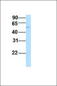 Anti-CAMKK2, (N-terminal) antibody produced in rabbit affinity isolated antibody