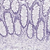 Anti-AQP2 antibody produced in rabbit Prestige Antibodies&#174; Powered by Atlas Antibodies, affinity isolated antibody, buffered aqueous glycerol solution