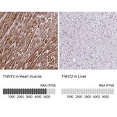 Anti-TNNT2 antibody produced in rabbit Prestige Antibodies&#174; Powered by Atlas Antibodies, affinity isolated antibody, buffered aqueous glycerol solution