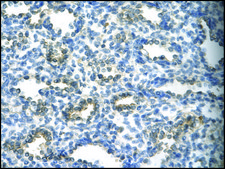 Anti-SUV39H1 antibody produced in rabbit IgG fraction of antiserum