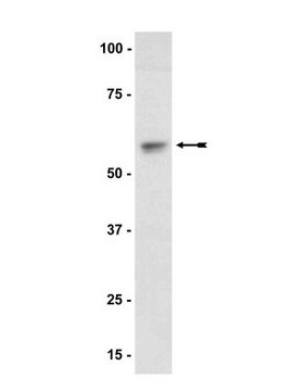 Anti-Akt1/PKB&#945; Antibody Upstate&#174;, from rabbit