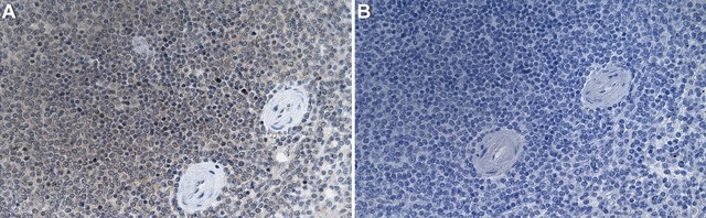 Anti-Interleukin-21 Antibody, clone 2B13 ZooMAb&#174; Rabbit Monoclonal recombinant, expressed in HEK 293 cells
