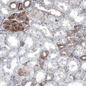 Anti-MYO1B antibody produced in rabbit Prestige Antibodies&#174; Powered by Atlas Antibodies, affinity isolated antibody, buffered aqueous glycerol solution