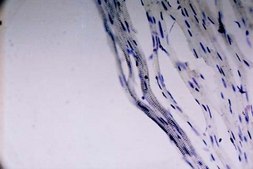 Anti-Sodium Channel Antibody, Voltage Gated, Pan (SP19 Segment) Chemicon&#174;, from rabbit