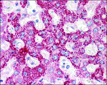 Anti-CRLF2 antibody produced in rabbit affinity isolated antibody