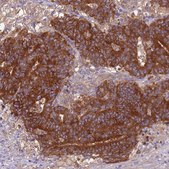 Anti-ARHGAP12 antibody produced in rabbit Prestige Antibodies&#174; Powered by Atlas Antibodies, affinity isolated antibody, buffered aqueous glycerol solution