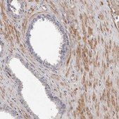 Anti-MRPS10 antibody produced in rabbit Prestige Antibodies&#174; Powered by Atlas Antibodies, affinity isolated antibody, buffered aqueous glycerol solution, ab1
