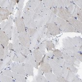 Anti-MYO1C antibody produced in rabbit Prestige Antibodies&#174; Powered by Atlas Antibodies, affinity isolated antibody, buffered aqueous glycerol solution