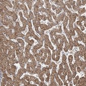 Anti-BDH2 antibody produced in rabbit Prestige Antibodies&#174; Powered by Atlas Antibodies, affinity isolated antibody, buffered aqueous glycerol solution