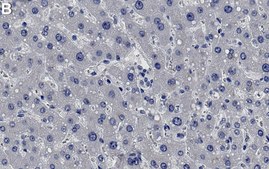 Anti-MRP2 Antibody, clone 1B2 ZooMAb&#174; Rabbit Monoclonal recombinant, expressed in HEK 293 cells