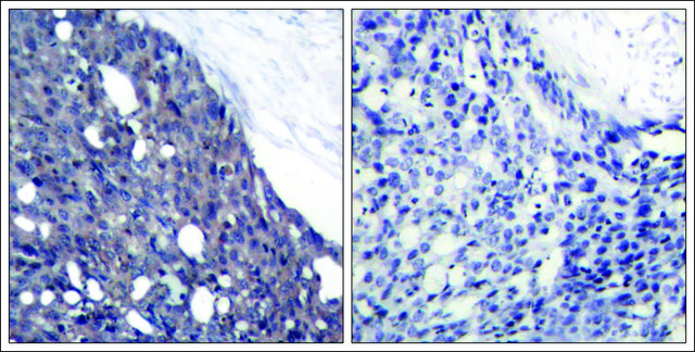 Anti-NFKBIA (Ab-42) antibody produced in rabbit affinity isolated antibody