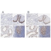 Anti-NCAPH antibody produced in rabbit Prestige Antibodies&#174; Powered by Atlas Antibodies, affinity isolated antibody, buffered aqueous glycerol solution