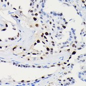 Anti- Cyclin D1 antibody produced in rabbit
