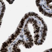 Anti-PGR antibody produced in rabbit Prestige Antibodies&#174; Powered by Atlas Antibodies, affinity isolated antibody, buffered aqueous glycerol solution