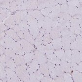 Anti-ATG3 antibody produced in rabbit Prestige Antibodies&#174; Powered by Atlas Antibodies, affinity isolated antibody, buffered aqueous glycerol solution