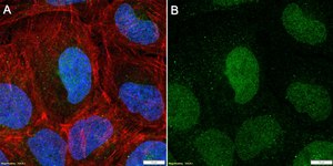 Anti-KEAP1 Antibody, clone 3B9 ZooMAb® Rabbit Monoclonal recombinant, expressed in HEK 293 cells