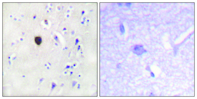 Anti-KIR6.2 antibody produced in rabbit affinity isolated antibody