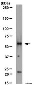 Anti-Tbr2 Antibody from rabbit, purified by affinity chromatography