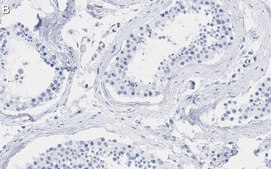 Anti-Smad2 Antibody, clone 2F15 ZooMAb&#174; Rabbit Monoclonal recombinant, expressed in HEK 293 cells