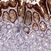 Anti-ADH7 antibody produced in rabbit Prestige Antibodies&#174; Powered by Atlas Antibodies, affinity isolated antibody, buffered aqueous glycerol solution