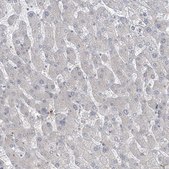 Anti-PPAT antibody produced in rabbit Prestige Antibodies&#174; Powered by Atlas Antibodies, affinity isolated antibody, buffered aqueous glycerol solution