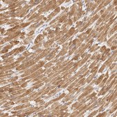 Anti-TFB2M antibody produced in rabbit Prestige Antibodies&#174; Powered by Atlas Antibodies, affinity isolated antibody, buffered aqueous glycerol solution