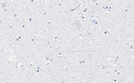 Anti-GAD65 Antibody, clone 3B23 ZooMAb&#174; Rabbit Monoclonal recombinant, expressed in HEK 293 cells