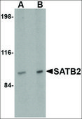 Anti-SATB2 (ab1) antibody produced in rabbit affinity isolated antibody, buffered aqueous solution