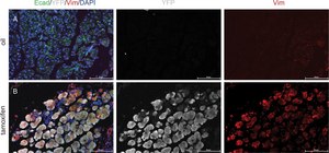 Anti-Vimentin Antibody serum, Chemicon&#174;