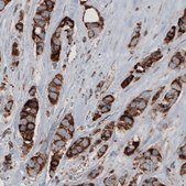 Monoclonal Anti-CS antibody produced in mouse Prestige Antibodies&#174; Powered by Atlas Antibodies, clone CL2553, purified immunoglobulin, buffered aqueous glycerol solution