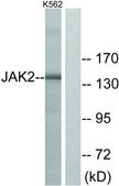 Anti-JAK2 antibody produced in rabbit affinity isolated antibody