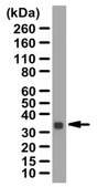 Anti-Calponin-1 Antibody from rabbit, purified by affinity chromatography