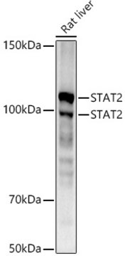 [KO Validated]Anti-STAT2 Antibody, clone 4A5P8, Rabbit Monoclonal