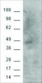 Anti-Cannabinoid receptor 1 antibody produced in goat affinity isolated antibody, buffered aqueous solution