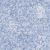 Anti-SALL4 antibody produced in rabbit Prestige Antibodies® Powered by Atlas Antibodies, affinity isolated antibody, buffered aqueous glycerol solution