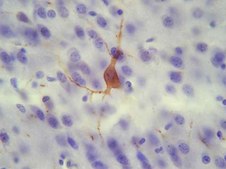 Anti-Substance P Receptor Antibody, pain serum, Chemicon&#174;