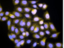 Anti-Rac1b Antibody Upstate&#174;, from rabbit