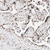 Anti-NRF1 antibody produced in rabbit Prestige Antibodies&#174; Powered by Atlas Antibodies, affinity isolated antibody, buffered aqueous glycerol solution