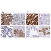 Anti-TNNC1 antibody produced in rabbit Prestige Antibodies&#174; Powered by Atlas Antibodies, affinity isolated antibody