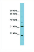 Anti-N6AMT1, (N-terminal) antibody produced in rabbit affinity isolated antibody