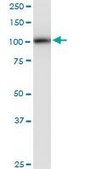 Monoclonal Anti-PLD2 antibody produced in mouse clone 1C5, purified immunoglobulin, buffered aqueous solution