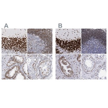 Anti-MECP2 antibody produced in rabbit Ab2, Prestige Antibodies® Powered by Atlas Antibodies, affinity isolated antibody, buffered aqueous glycerol solution