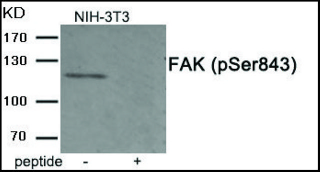 Anti-phospho-FAK (pSer843) antibody produced in rabbit affinity isolated antibody