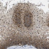 Anti-ZDHHC5 antibody produced in rabbit Prestige Antibodies&#174; Powered by Atlas Antibodies, affinity isolated antibody, buffered aqueous glycerol solution