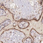 Anti-GAB2 antibody produced in rabbit Prestige Antibodies&#174; Powered by Atlas Antibodies, affinity isolated antibody, buffered aqueous glycerol solution