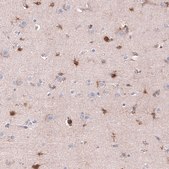 Monoclonal Anti-CHI3L1 antibody produced in mouse Prestige Antibodies® Powered by Atlas Antibodies, clone CL12314, purified immunoglobulin, buffered aqueous glycerol solution