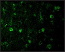 Anti-Rheb (ab2) antibody produced in rabbit affinity isolated antibody, buffered aqueous solution