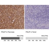 Anti-PNLIP antibody produced in rabbit Prestige Antibodies&#174; Powered by Atlas Antibodies, affinity isolated antibody, buffered aqueous glycerol solution