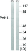 Anti-PAK1 antibody produced in rabbit affinity isolated antibody
